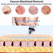 150mAh Rechargeable Electric Blackhead Vacuum Cleaner, Portable Facial Pore Cleansing Suction Device - Multicolor - View 3