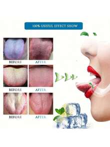 Bộ 3 dụng cụ làm sạch lưỡi, được thiết kế để loại bỏ hiệu quả vi khuẩn, cặn thức ăn và các chất gây mùi hôi trên bề mặt lưỡi. Như hình ảnh so sánh cho thấy, nó có thể biến một chiếc lưỡi bẩn thành một chiếc lưỡi sạch sẽ và khỏe mạnh. - A - Xem 8