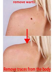 And They Will Fall Off Naturally In 7 Days Without Leaving Any Marks - Pack Of 1Pcs - View 2