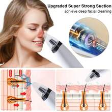 150mAh Rechargeable Electric Blackhead Vacuum Cleaner, Portable Facial Pore Cleansing Suction Device - Multicolor - View 4