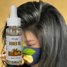 MELAO 生姜精油，专为头皮护理而设计，蕴含纯生姜提取物，滋养头皮，令秀发亮泽、柔软、强韧，30毫升/1.01液盎司，配有滴管 - 薑 - 查看 5