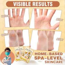Hydrating Hand And Foot Mask, 3 Foot &Amp; 3 Hand Mask, Hand And Foot Care After Pedicure, Moisturizing Socks For Dry, Cracked Heel, Foot Spa, Honey &Amp; Milk, Vitamin E - ColorA - View 4