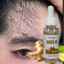 MELAO 生姜精油，专为头皮护理而设计，蕴含纯生姜提取物，滋养头皮，令秀发亮泽、柔软、强韧，30毫升/1.01液盎司，配有滴管 - 薑 - 查看 1