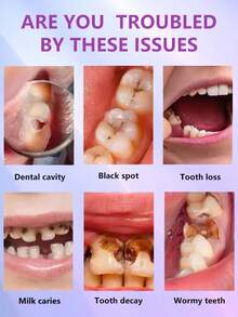 Teeth Cleaning Toothpaste Removes Tooth Stains Teeth Whitening Tooth Decay Repair Calculus Plaque Periodontitis Remove Cavities - Hộp 100g - Xem 4