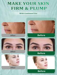 5片装胶原蛋白面膜，深层补水，富含胶原蛋白，提升肌肤光泽和柔滑度，告别干燥暗沉肤色，面部护理 - Collagen - 查看 4