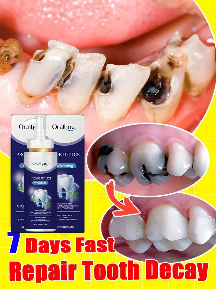 Teeth Cleaning Toothpaste Removes Tooth Stains Teeth Whitening Tooth Decay Repair Calculus Plaque Periodontitis Remove Cavities - Hộp 100g - Xem 1