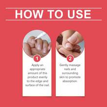 1 Set,Nail Surface Keratin Care, Deeply Nourishes Nails, Brightens Nails, Strengthens Nail Thickness, Suitable For Weak Nails - bộ - Xem 9