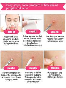 Kit de limpeza facial com ferramentas e adesivos transparentes de bolinhas. Design fofo de bolinhas, adesivos faciais invisíveis, ferramentas de extração e limpeza adequadas para todos os tipos de pele, com estojo portátil. Limpeza profunda, ferramentas de cuidados com a pele, ferramentas de beleza, adesivos decorativos para o rosto, presentes para o ano 2000, formatura, aniversário, feriados, inverno, primavera, decoração de festivais e cosplay feminino. - Multicolorido - Ver 3