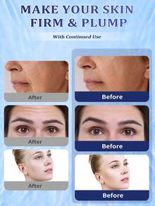 5片装生物胶原蛋白保湿面膜，富含烟酰胺和透明质酸，紧致柔滑肌肤，令肌肤柔软细腻、富有弹性，自然透亮，并具有保湿护理功效，适合所有肤质。 - Collagen - 查看 4