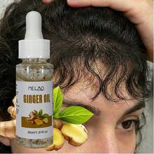 MELAO 生姜精油，专为头皮护理而设计，蕴含纯生姜提取物，滋养头皮，令秀发亮泽、柔软、强韧，30毫升/1.01液盎司，配有滴管 - 薑 - 查看 4