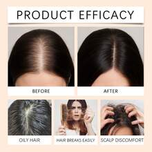 Onion Biotin Shampoo Refreshing And Moisturizing Suitable For All Hair Types Moisturizing And Smoothing Rich In Rosemary Extract Daily Gentle Cleaning Fluffy And Smooth Care For Hair - Hương thơm nhẹ - Xem 9