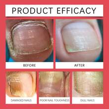 1 Set,Nail Surface Keratin Care, Deeply Nourishes Nails, Brightens Nails, Strengthens Nail Thickness, Suitable For Weak Nails - bộ - Xem 2