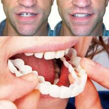 2pcs/Set Soft White Comfortable Tooth Veneers, Smile Dental Covers, Includes Upper And Lower Rows, Unisex Easy To Wear Tooth Concealing Solution, Boost Confidence, Temporary Cosmetic Tooth Covers, Universal Tooth Defect Repair Veneers - White - View 3