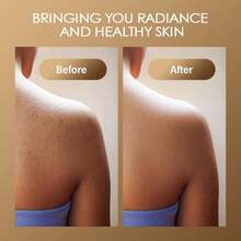 Turmeric Body Scrub Vitamin C Exfoliating Body Scrub With Collagen And Coconut Oil Body Exfoliator Dead Skin Remover Smooth And Hydrated Natural Scrub For Butt Bikini Area With Loofah - White - 查看 4