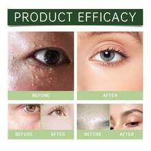 Skin Care Skin Repair Fat Particles Moisturizing Delicate Smooth Skin Care Tool - 1 - 查看 6