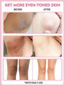 6/3/1件装腹股沟美白霜，胶原蛋白亮白霜，含植物提取物和胶原蛋白的美白祛斑身体乳，腋下美白霜，美白润肤露，提亮肤色，可用于腋下 - 嫩白霜 - 查看 3