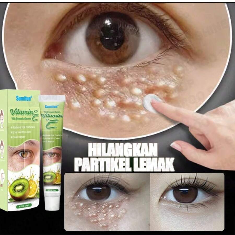 Eye Care Effectively Eliminates Eye Puffiness And Repairs Eye Skin With Particles - 1件 - 查看 1