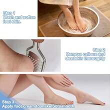 Professional Foot Scrubber Dead Skin Remover, Pedicure Foot File Callus Removal, Heel Scraper For Cracked Heels, Microplane Cheese Grater For Feet, Foot Rasp For Hard Skin(T1) - ColorA - 查看 4