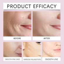 40 Pieces Facial Masks, Skincare Tools, Facial Care Strips Suitable For All Skin Types - Transparent V-Shaped Eye Mask And Neck/Broad-Shoulder Area Tightening Patches, Invisible Firming Patches, Made Of Thermoplastic Polyurethane, Instantly Firm And Lift The Skin. - Multicolor - View 5