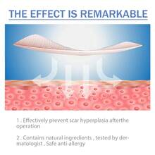 South Moon Silicone Patch, Fading Patch, Waterproof Breathable Skin Patch, Beauty Patch - Multicolor - View 3