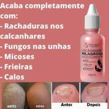 Kit 2 Loção Milagrosa Para Os Pés 30Ml - Bio Instinto - Multicolorido - Visão 5