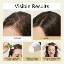 GleamXi 生姜滚珠精油，滋养秀发，轻盈柔滑，清爽头皮，日常护发油 - 正裝 - 查看 2