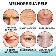 Kit  Adesivo Facial Anti Ruga Reposição de Colágeno Reutilizável Silicone Testa Bigode - 1 Pacote (5 adesivos) - Visão 3