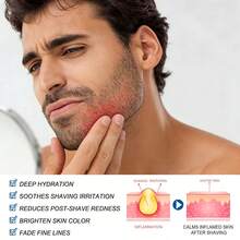 1. Men's Post-Shave Soothing Moisturizer, Oil-Free Witch Hazel Formula, Reduces Irritation & Redness, Hydrating Nourishing For Fragile Skin, Gentle For Sensitive Skin, Daily Grooming Facial Care Unscented - 50g - View 7