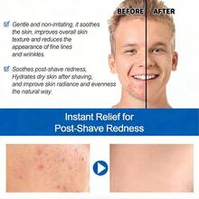 1. Men's Post-Shave Soothing Moisturizer, Oil-Free Witch Hazel Formula, Reduces Irritation & Redness, Hydrating Nourishing For Fragile Skin, Gentle For Sensitive Skin, Daily Grooming Facial Care Unscented - 50g - View 4