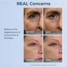 Rapid Reduction Eye Serum - Visibly Reduces Under-Eye Bags, Wrinkles, Dark Circles, Fine Lines & Crow's Feet Instantly, Anti Aging Wrinkle Remover For Face, Full Size Tube - Retinol - 查看 6