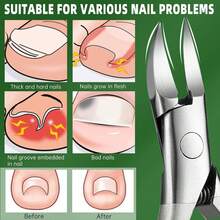 1pc Stainless Steel Toenail Clipper, Household Simple Toe Nail Nipper, Unisex Foot Care Tool, Pedicure, Ingrown Nail - 彩色 - 查看 10