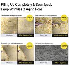 0.1% 视黄醇，3% Matrixyl 浓缩视黄醇精华液 | 抗衰老、收缩毛孔、减少皱纹和细纹、紧致肌肤，15毫升 - 視黃醇霜 - 查看 5