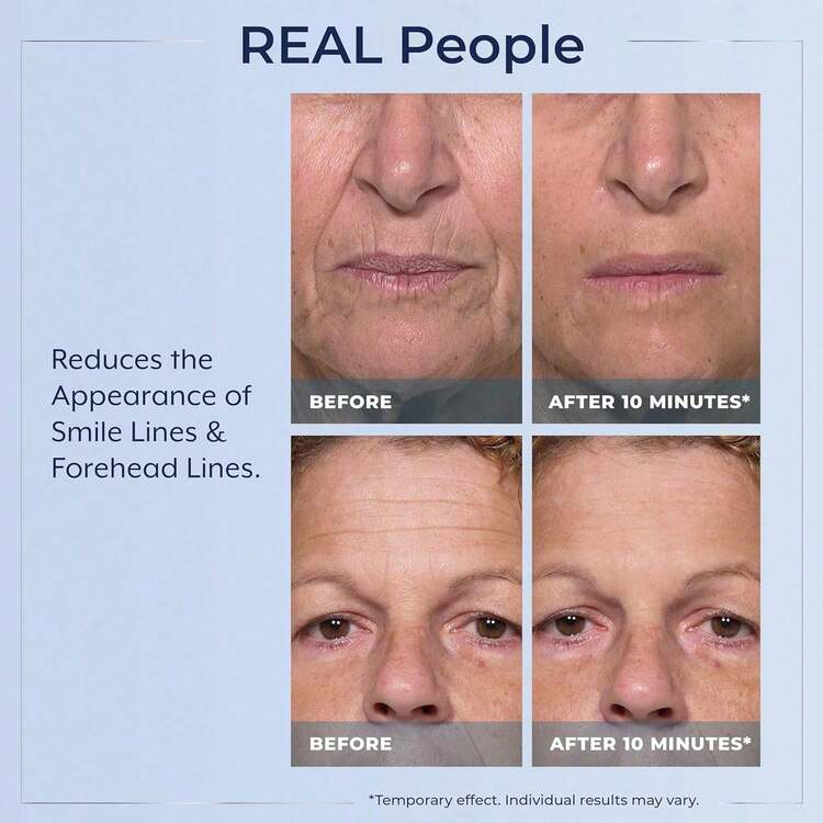 Rapid Reduction Eye Serum - Visibly Reduces Under-Eye Bags, Wrinkles, Dark Circles, Fine Lines & Crow's Feet Instantly, Anti Aging Wrinkle Remover For Face, Full Size Tube - Retinol - 查看 5