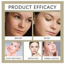 7% 果酸温和去角质爽肤水，7% 果酸爽肤水淡化色斑和细纹，面部去角质精华，保湿并减少皮肤瑕疵 - B5 - 查看 10