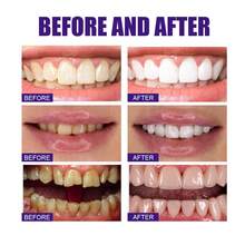 JAYSUING 30ml Pasta Dental Blanqueadora Púrpura V34 - Elimina Manchas, Cuidado Suave para Dientes Sensibles, Aliento Fresco, Blanqueamiento Profundo contra Té/Café, para Dientes y Encías Saludables (Limpieza Diaria, Antisarro),regalos para hombres y mujeres adecuados para San Valentín, Año Nuevo, cumpleaños, bodas y fiestas,pasta de dientes blanqueadora,ofertas,Envío Gratis - pasta - Ver 3