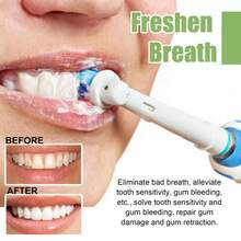 10pcs Esencia Blanqueadora Dental - Elimina Manchas Amarillas, Mal Aliento y Sensibilidad | con Bicarbonato | Para Dientes Blancos y Cuidado Diario,regalos para hombres y mujeres adecuados para San Valentín, Año Nuevo, cumpleaños, bodas y fiestas,pasta de dientes blanqueadora,ofertas,Envío Gratis - suero - Ver 7