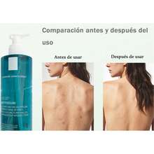 Lifuquan Cleaning skin Cleaning gel - Gel de limpieza de la piel con ácido salvífico, limpieza del acné y limpieza de la piel, eliminando el acné de cabeza negra y la boca cerrada, 400 ml, adecuado para la espalda, el pecho y la cara - Limpieza profunda - Ver 9