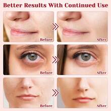 龙血舒缓面霜，含视黄醇和胎盘提取物；龙血抗皱面霜，女士抗衰老保湿护肤品 - Collagen - 查看 3