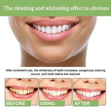 10pcs Esencia Blanqueadora Dental - Elimina Manchas Amarillas, Mal Aliento y Sensibilidad | con Bicarbonato | Para Dientes Blancos y Cuidado Diario,regalos para hombres y mujeres adecuados para San Valentín, Año Nuevo, cumpleaños, bodas y fiestas,pasta de dientes blanqueadora,ofertas,Envío Gratis - suero - Ver 8