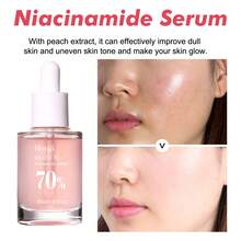 Hoygi 3-Piece Niacinamide Serum Set: Firms Skin And Moisturizes Pores, Improves The Look Of Acne Scars, Reduces The Appearance Of Dry Lines, Helps Cover Blemishes, Softens, Hydrates, And Brightens Skin. Skincare Products, Valentine's Day Gift. - 粉紅色 - 查看 2