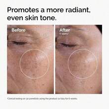 Glycolic Acid Toner, Reduces Blemishes And Closed Comedones, Moisturizing And Nourishing Facial Toner, Exfoliating Facial Toner, Pore-Tightening Toner, Smooths Skin, Evens Skin Tone, Moisturizing Formula - Be - Xem 8
