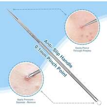 Stainless Steel Blackhead Remover, Pimple Extractor, Pimple Popper, Comedone Extractor, Surgical Grade Acne Treatment Tool, 3rd Generation Blemish Removal Kit For Face, Nose, T-Zone, 2Pcs - / - View 2