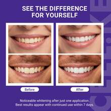[CEELIKE] Purple Whitening Strips With Free Cheek Retractor – 7/21 Treatments – Nano-Hydroxyapatite For Enamel Protection – Peroxide-Free Formula - 24 bài đăng - Xem 6