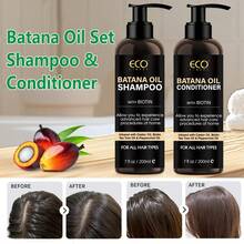 Batana Oil Shampoo And Conditioner Set - Deep Cleaning, Nourishing & Moisturizing Hair, With Biotin For Volume Fortify, Make Thin Hair Look Fully, Anti-Frizzing, Leave Soft & Smoooth Hair, Add Shine - Biotin Shampoo For Thinning Hair For Men & Women, 200ml*2 - 洗髮+護髮素 - 查看 1