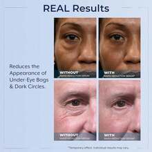 Rapid Reduction Eye Serum - Visibly Reduces Under-Eye Bags, Wrinkles, Dark Circles, Fine Lines & Crow's Feet Instantly, Anti Aging Wrinkle Remover For Face, Full Size Tube - Retinol - Xem 7