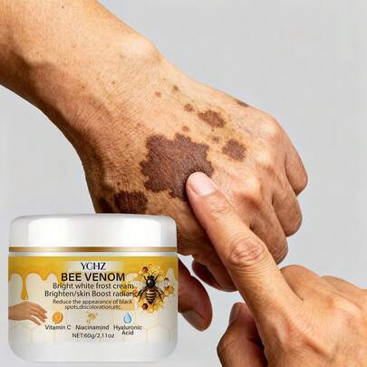 YCHZ ครีมบำรุงผิวหน้า Bee Brightening, มีส่วนผสมของไนอะซินาไมด์, กรดไฮยาลูโรนิก, วิตามินซีและอี | สูตรอ่อนโยน, เหมาะสำหรับทุกสีผิวโทนเบจอ่อน, ช่วยให้ผิวหน้ากระจ่างใสและเปล่งประกาย, เหมาะสำหรับใบหน้าและลำตัว, ปราศจากน้ำหอม, ให้ความชุ่มชื้น