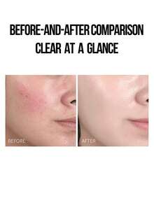 Estée Lauder 30/200ml Loción hidratante de microesencia fermentada de Sakura, que contiene talla grande de 12 esencias fermentadas de Sakura probióticas, aumenta la hidratación de la piel en un 71%, hidratación durante 24 horas, enfriamiento y calmante en 1 minuto, calma el enrojecimiento, repara la piel dañada, apta para piel grasa - Microesencia de flor de cerezo de Estée Lauder - Ver 3