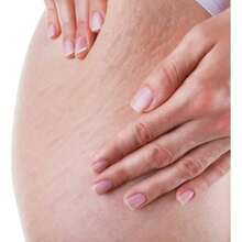 BioOil Aceite Multifunción Premium - Reduce Cicatrices y Estrías, Reafirma la Piel, Hidrata Intensamente y Mejora la Textura. Formula Suave y No Grasa, Apto para Todo Tipo de Piel. - 200 ml - Ver 8