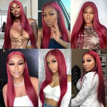 13x4 透明蕾丝前假发，真人前额发丝，99j 酒红色，200 密度，仿真肤色，高清全蕾丝前假发，混合发丝，预先拔毛，漂白发结，直发假发，28 英寸 - SBUG - 查看 10