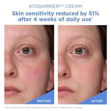 AESTURA ATOBARRIER365 Cream With Ceramides, Korean Face Moisturizer For Barrier Repair | 120H Lasting Hydration, Ceramide Capsules, Dry & Sensitive Skin, Non-Comedogenic, 80 ML / 2.70 Fl.Oz. - 乳霜 - 查看 6